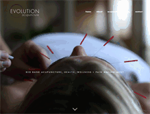 Tablet Screenshot of acuevolution.com